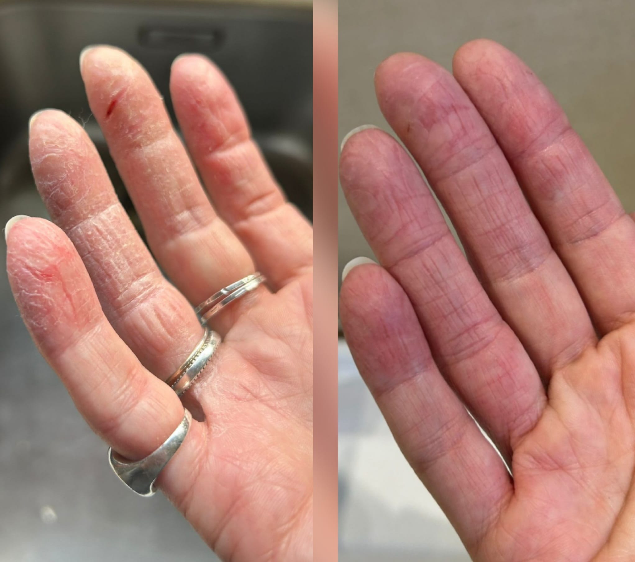 Miracletox Angelto Cream 50g RRP £29.00 / €34.00