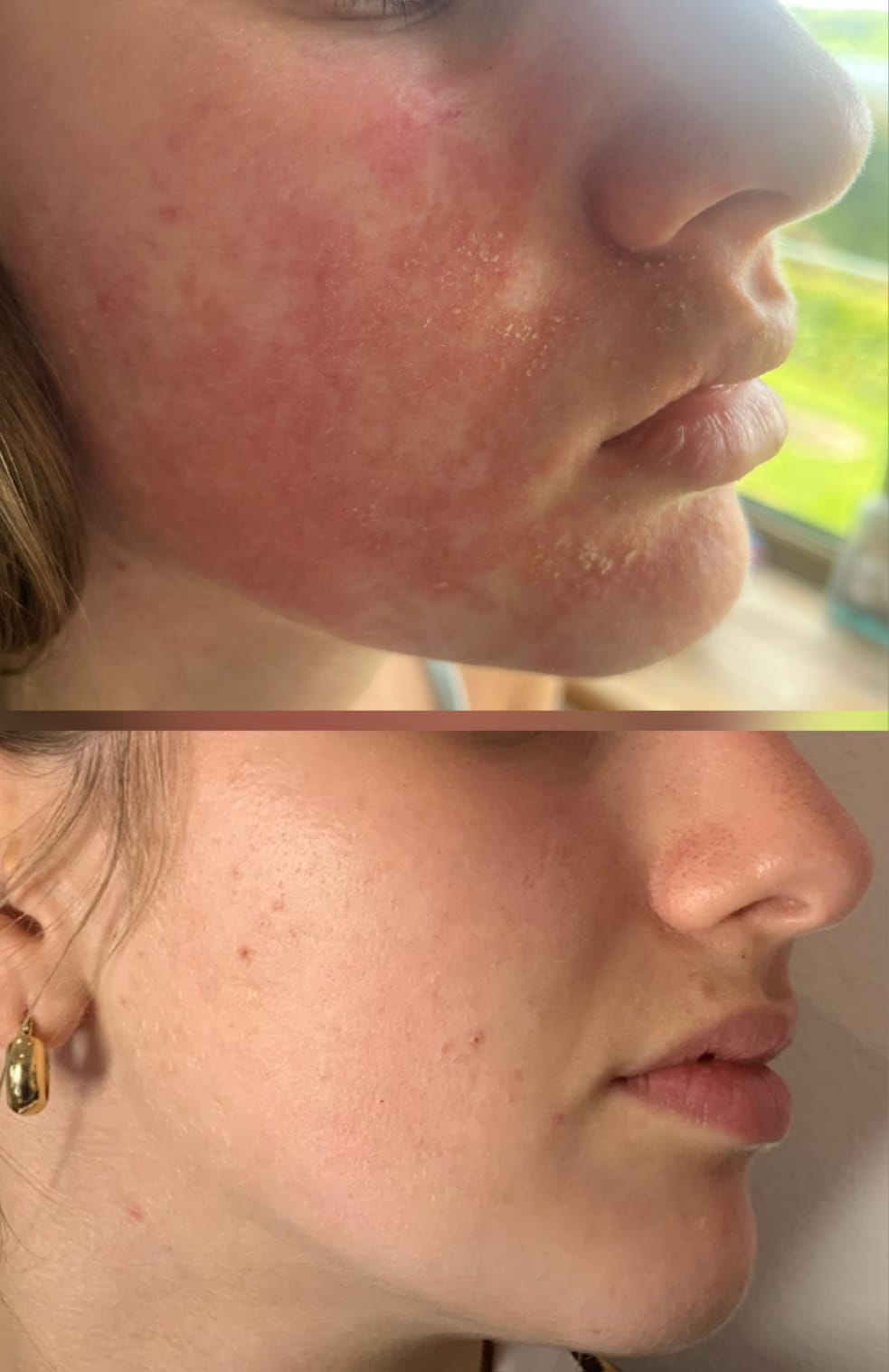 Miracletox Angelto Cream 50g RRP £29.00 / €34.00