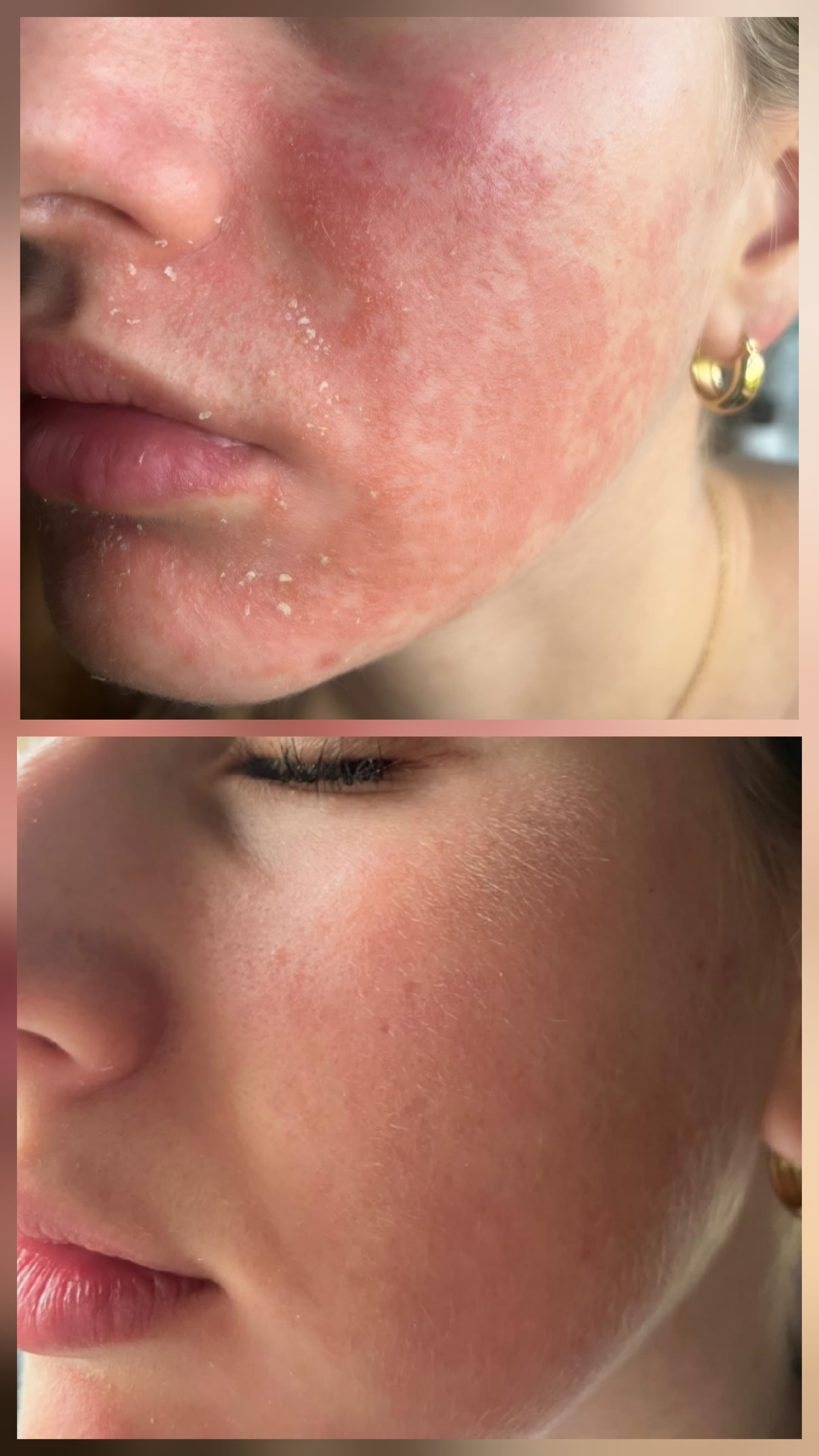 Miracletox Angelto Cream 50g RRP £29.00 / €34.00